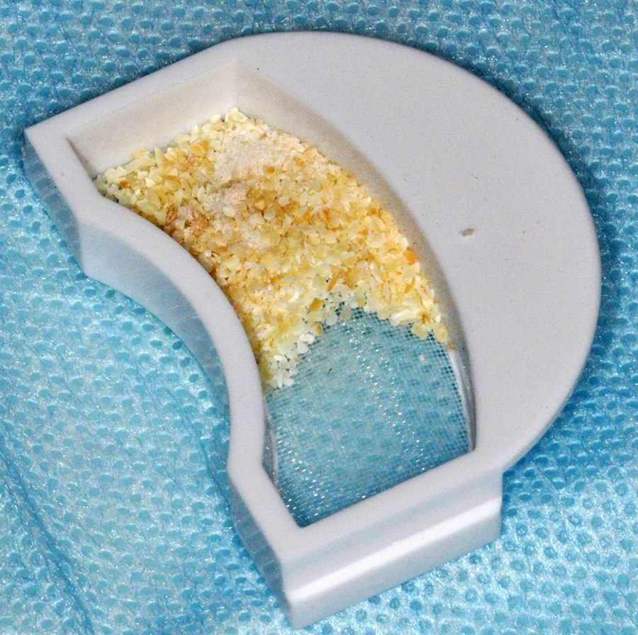 Ryc. 3 Biomateriał powstały w wyniku sprocesowania usuniętego zęba